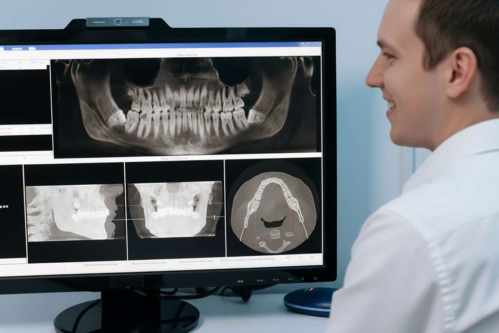 Dental Xrays